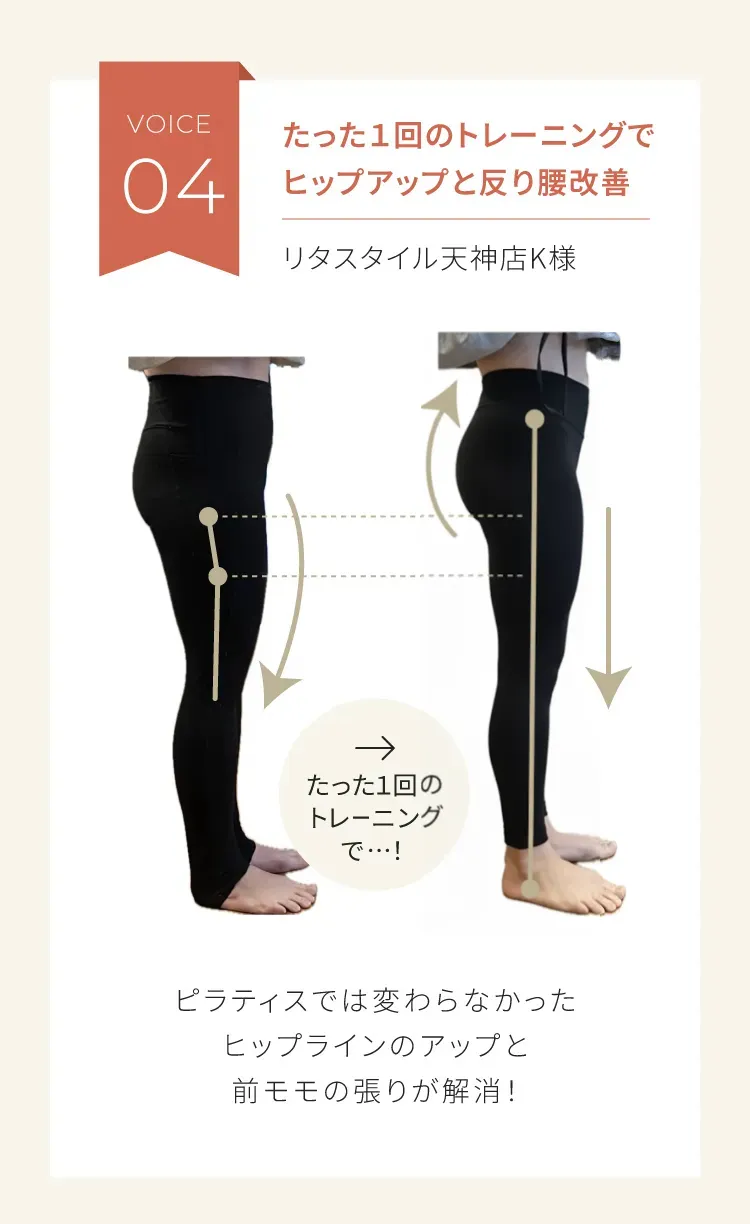 たった1回のトレーニングでヒップアップと反り腰改善　リタスタイル天神店　Kさま女性　ピラティスでは変わらなかったヒップラインのアップと前モモの張りが解消