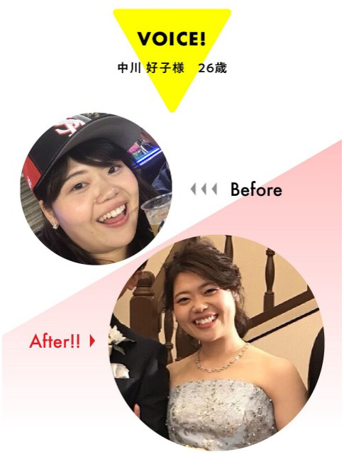 体験談